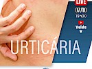 urticaria